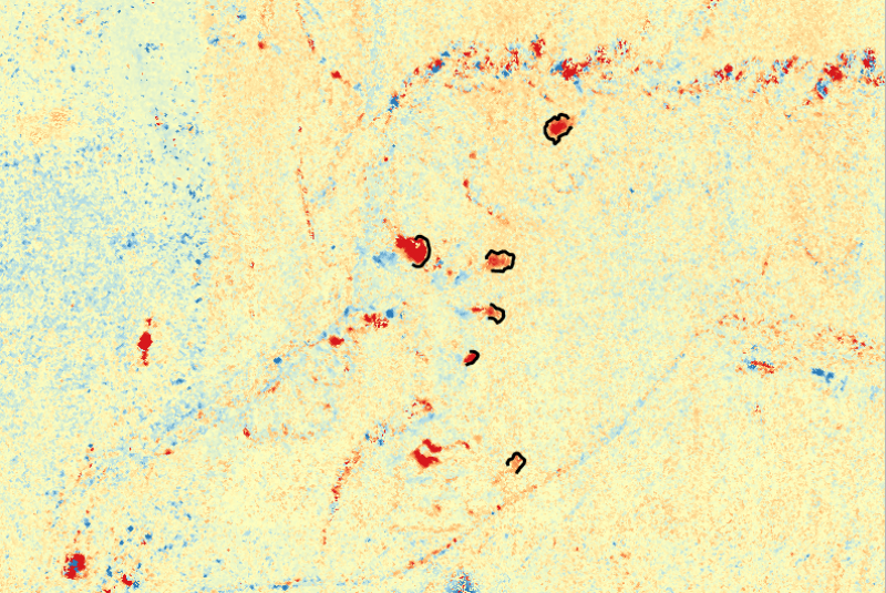 Fig.1 ArcticDEM: Elevation change of retrogressive thaw slumps in Eureka, Canada. Fig.1 ArcticDEM: Elevation change of retrogressive thaw slumps in Eureka, Canada.
