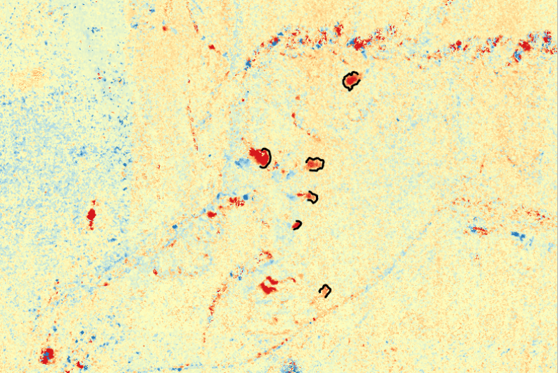 Fig.1  ArcticDEM: Elevation change of retrogressive thaw slumps in Eureka, Canada.