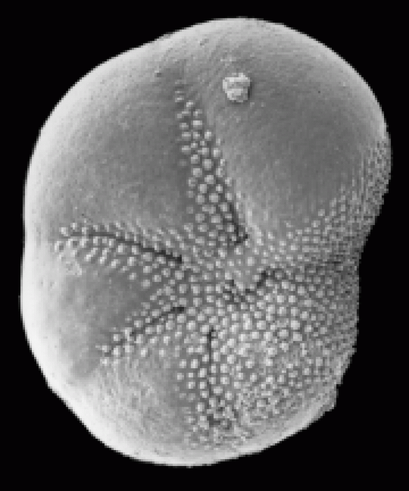 Elphidium subarcticum 3 Elphidium subarcticum 3