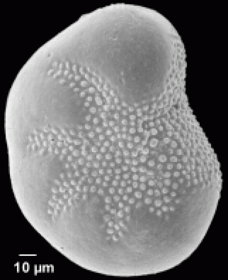 Elphidium subarcticum 2 Elphidium subarcticum 2