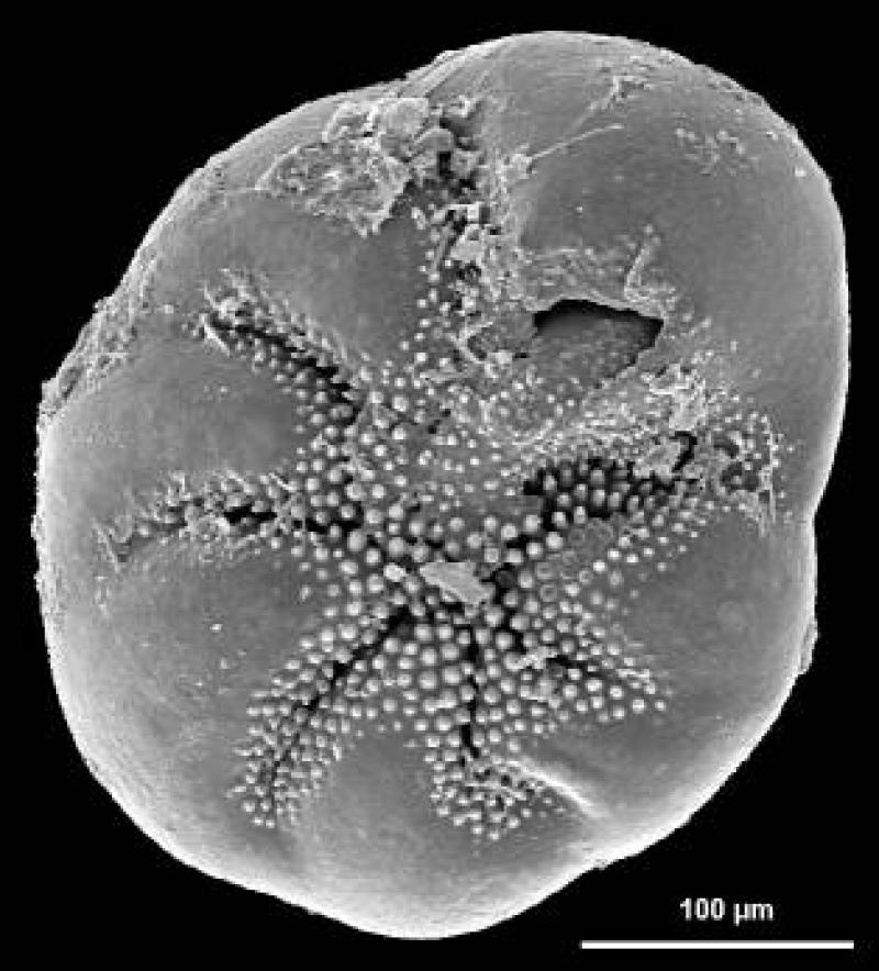 Discorbidae spp. 1 Discorbidae spp. 1