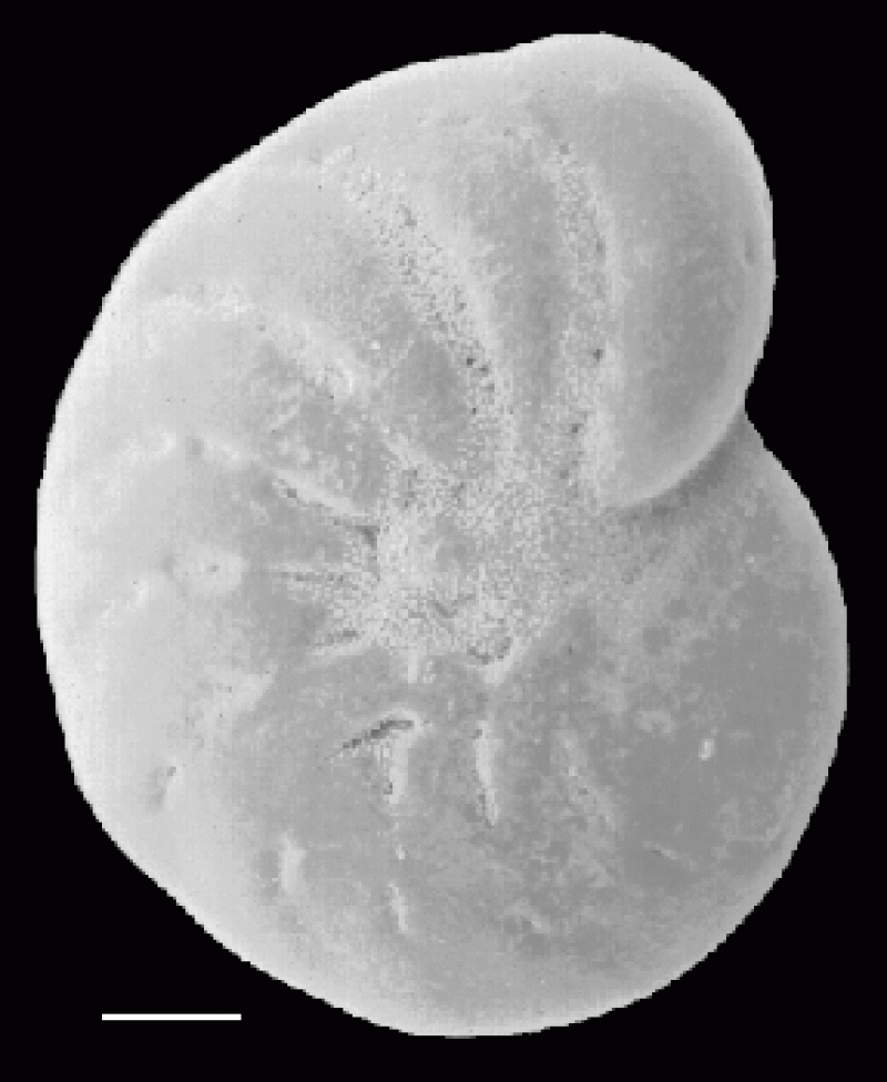 Elphidium incertum 1