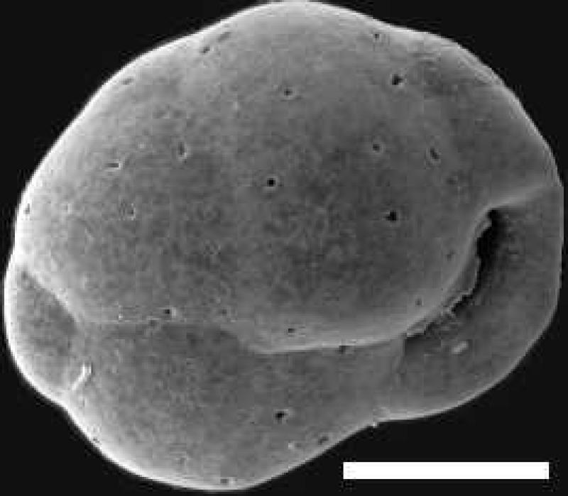 Cassidulina reniforme 1 Cassidulina reniforme 1