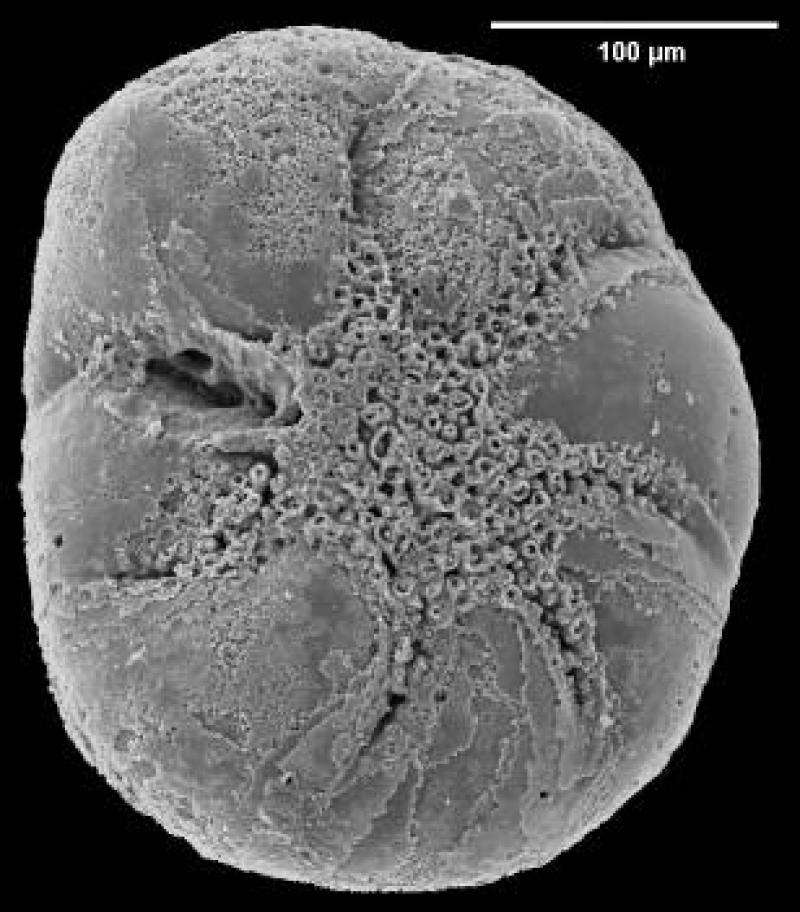 Discorbidae spp. 5 Discorbidae spp. 5