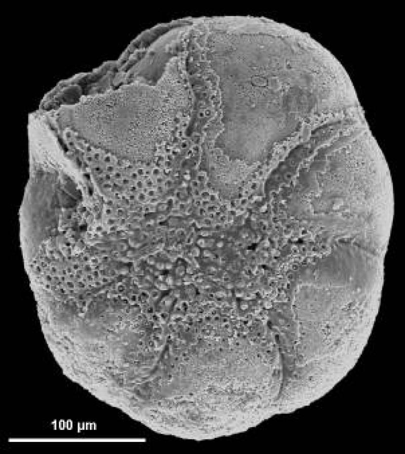 Discorbidae spp. 7 Discorbidae spp. 7