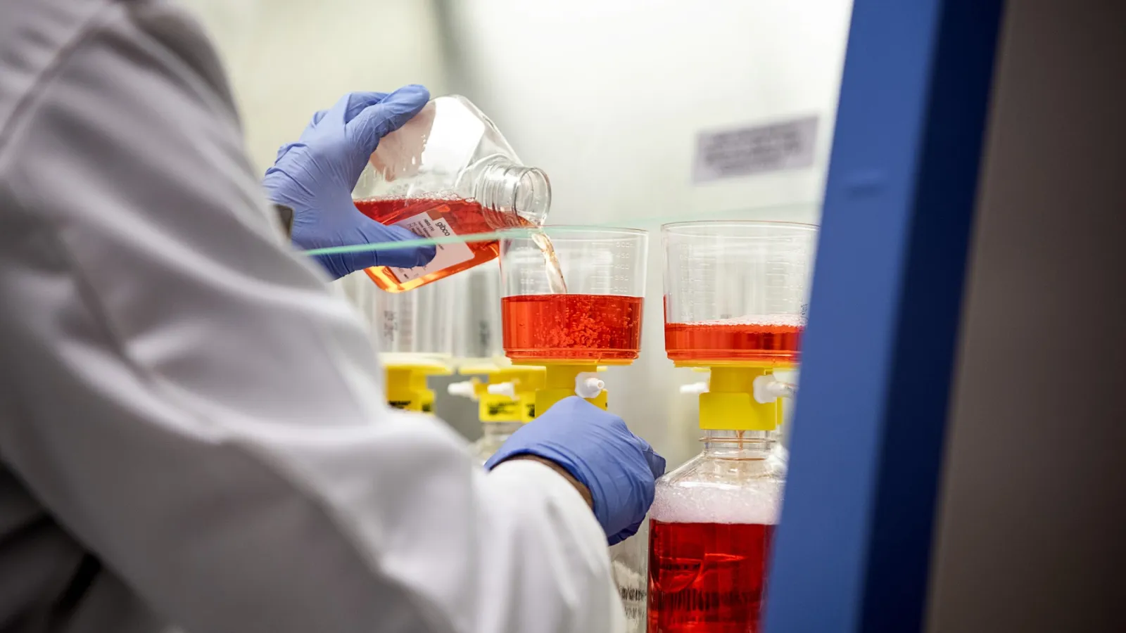 New viral transport media for COVID-19 test kits created by The Ohio State University Wexner Medical Center will allow more people to be tested for the coronavirus that causes the disease.