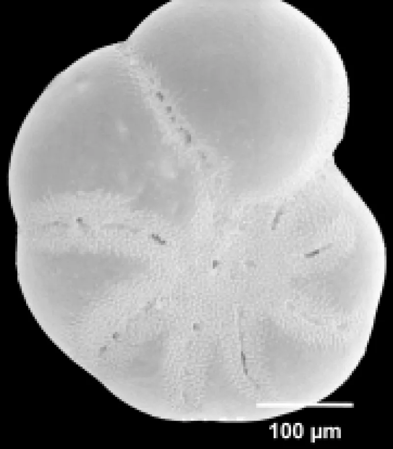 Elphidium subarcticum 1